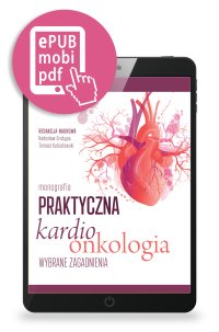 Praktyczna kardioonkologia. Wybrane zagadnienia - Radosław Grabysa - ebook