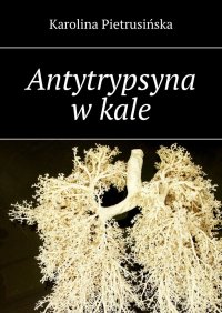 Antytrypsyna w kale - Karolina Pietrusińska - ebook
