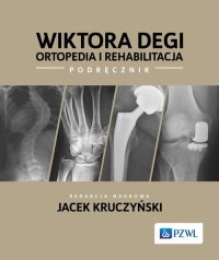 Wiktora Degi ortopedia i rehabilitacja - Jacek Kruczyński - ebook