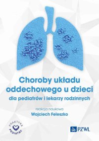 Choroby układu oddechowego u dzieci - Wojciech Feleszko - ebook