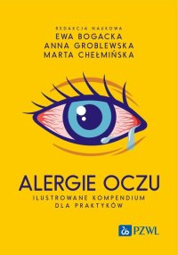 Alergie oczu. Ilustrowane kompendium dla praktyków - Ewa Bogacka - ebook