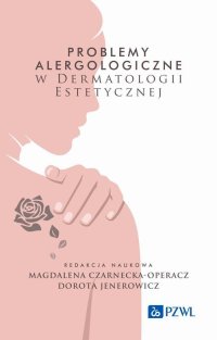 Problemy alergologiczne w dermatologii estetycznej - Magdalena Czarnecka-Operacz - ebook