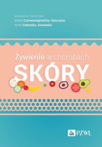 Żywienie w chorobach skóry - Anna Zalewska-Janowska - ebook