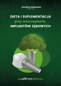 Dieta i suplementacja przy wszczepieniu implantów zębowych - Karolina Rybarska - ebook
