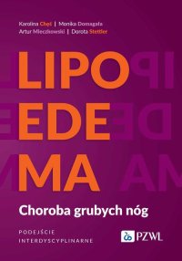 Lipoedema - Karolina Chęś - ebook