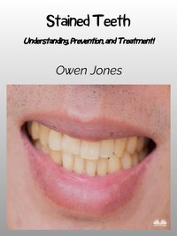 Stained Teeth - Owen Jones - ebook