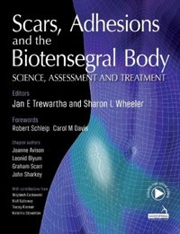 Scars, Adhesions and the Biotensegral Body [DRM] - Sharon Wheeler - ebook