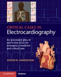 Critical Cases in Electrocardiography [DRM] - Steven R. Lowenstein - ebook