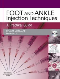 Foot and Ankle Injection Techniques [DRM] - Stuart Metcalfe - ebook