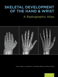 Skeletal Development of the Hand and Wrist [DRM] - J. Christoper Bertozzi - ebook