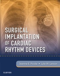 Surgical Implantation of Cardiac Rhythm Devices E-Book [DRM] - Lyle W. Larson - ebook