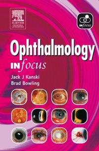 Ophthalmology In Focus [DRM] - Jack J. Kanski - ebook