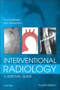 Interventional Radiology: A Survival Guide E-Book [DRM] - Iain Robertson - ebook
