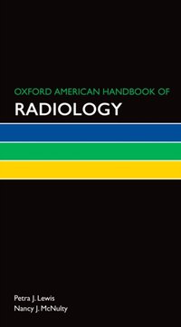 Oxford American Handbook of Radiology [DRM] - Nancy J. McNulty - ebook