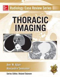 Radiology Case Review Series: Thoracic Imaging [DRM] - Alexander Semionov - ebook
