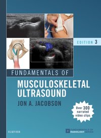 Fundamentals of Musculoskeletal Ultrasound E-Book [DRM] - Jon A. Jacobson - ebook