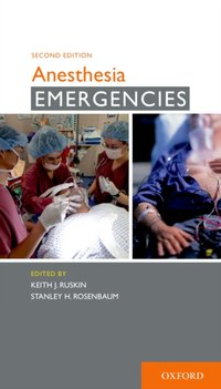 Anesthesia Emergencies [DRM] - Stanley H. Rosenbaum - ebook
