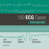 150 ECG Cases [DRM] - John Hampton - ebook