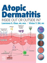 Atopic Dermatitis: Inside Out or Outside In - E-Book [DRM] - Vivian Y. Shi - ebook