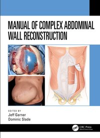 Manual of Complex Abdominal Wall Reconstruction [DRM] - Dominic Slade - ebook