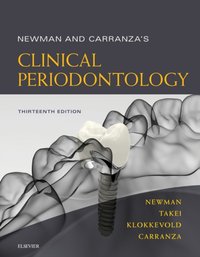 Newman and Carranza's Clinical Periodontology E-Book [DRM] - Fermin A. Carranza - ebook