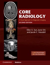 Core Radiology [DRM] - Junzi Shi - ebook