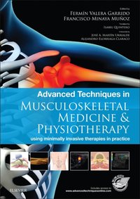 Advanced Techniques in Musculoskeletal Medicine & Physiotherapy - E-Book [DRM] - Francisco Minaya Munoz - ebook