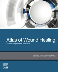 Atlas of Wound Healing [DRM] - Soheila S Kordestani - ebook