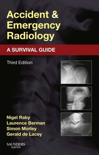 Accident and Emergency Radiology: A Survival Guide [DRM] - Gerald de Lacey - ebook