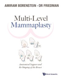 Multi-level Mammaplasty: Anatomical Support And Re-shaping Of The Breast [DRM] - Friedman Or Friedman - ebook