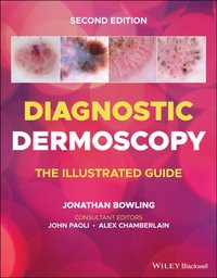 Diagnostic Dermoscopy [DRM] - Jonathan Bowling - ebook
