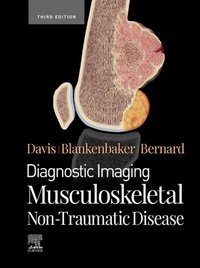 Diagnostic Imaging: Musculoskeletal Non-Traumatic Disease - E-Book [DRM] - Stephanie Bernard - ebook
