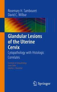 Glandular Lesions of the Uterine Cervix [DRM] - David C. Wilbur - ebook