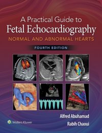 Practical Guide to Fetal Echocardiography [DRM] - Rabih Chaoui - ebook