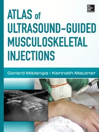 Atlas of Ultrasound-Guided Musculoskeletal Injections [DRM] - Kenneth Mautner - ebook