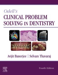 Odell's Clinical Problem Solving in Dentistry E-Book [DRM] - Selvam Thavaraj - ebook