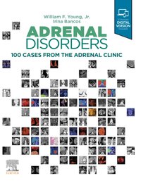 Adrenal Disorders,E-Book [DRM] - Irina Bancos - ebook