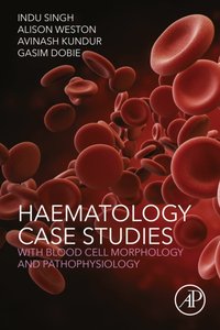 Haematology Case Studies with Blood Cell Morphology and Pathophysiology [DRM] - Gasim Dobie - ebook