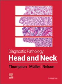 Diagnostic Pathology: Head and Neck,E-Book [DRM] - Brenda L. Nelson - ebook