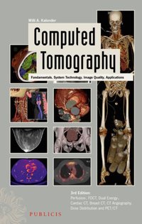 Computed Tomography [DRM] - Willi A. Kalender - ebook