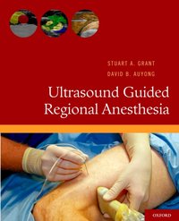 Ultrasound Guided Regional Anesthesia [DRM] - David B. Auyong - ebook