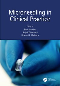 Microneedling in Clinical Practice [DRM] - Howard Maibach - ebook