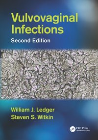 Vulvovaginal Infections [DRM] - Steven S. Witkin - ebook