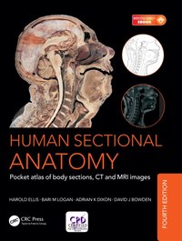 Human Sectional Anatomy [DRM] - Harold Ellis - ebook
