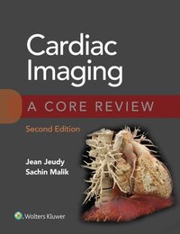 Cardiac Imaging: A Core Review [DRM] - Sachin Malik - ebook