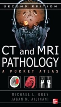 CT & MRI Pathology: A Pocket Atlas, Second Edition [DRM] - Jagan Mohan Ailinani - ebook