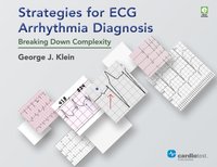 Strategies for ECG Arrhythmia Diagnosis [DRM] - Peter Leong-Sit - ebook