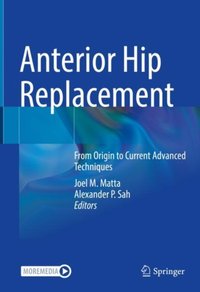Anterior Hip Replacement [DRM] - Joel M. Matta - ebook