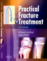 Practical Fracture Treatment E-Book [DRM] - Max Esser - ebook