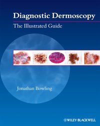 Diagnostic Dermoscopy [DRM] - Jonathan Bowling - ebook